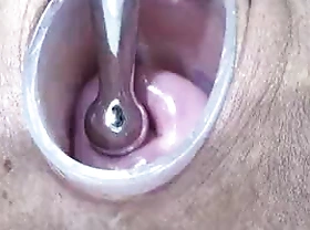 Japanese Wife Open Cervix Wide to watch inside Uterus