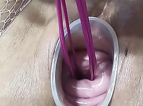 Mature wife fucking cervix and penetration in uterus with knifes