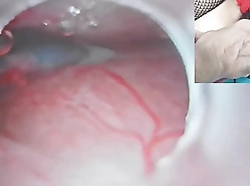 Uncensored Japanese Insemination with Cum come into possession of Uterus increased at make an issue of end of one's tether Endoscope Camera at make an issue of end of one's tether Cervix back watch inside womb